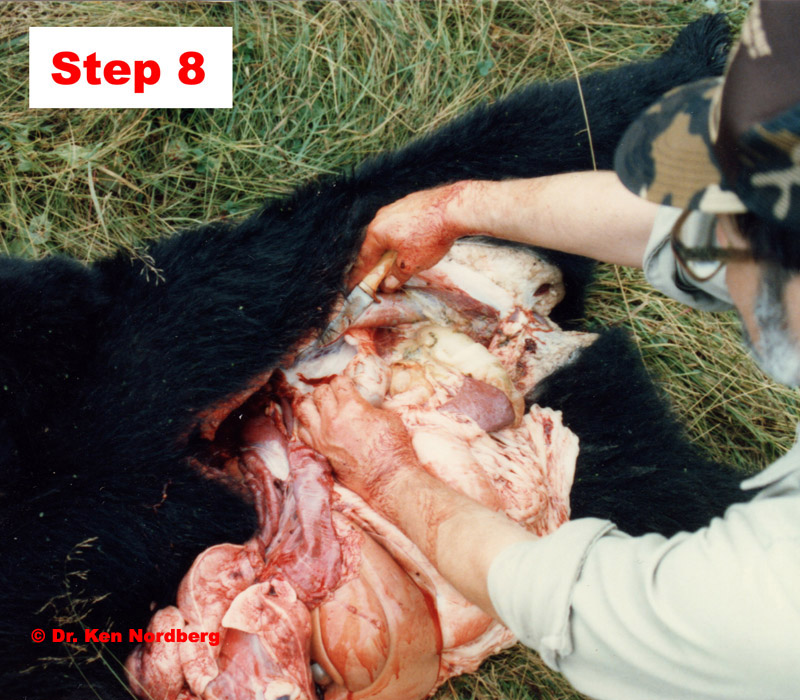 Step 8 Cutting the Omentum